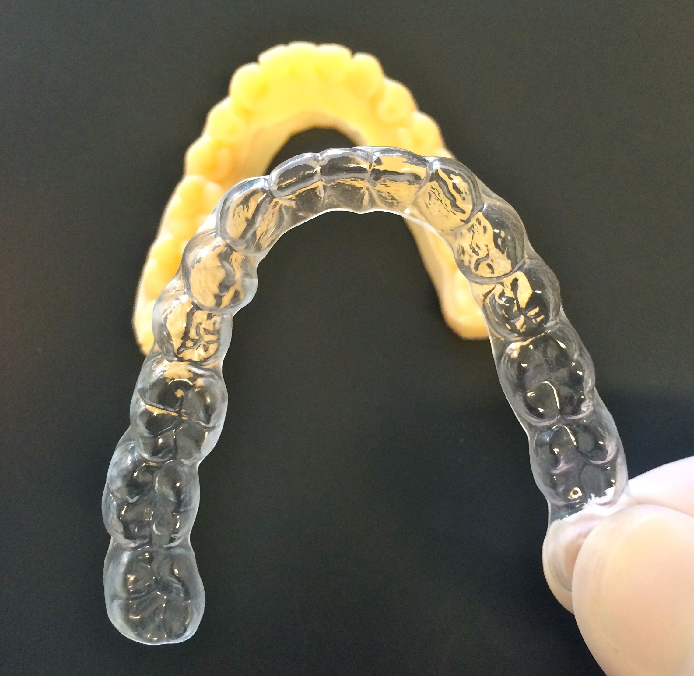 Orthodontie : gouttières d’alignement