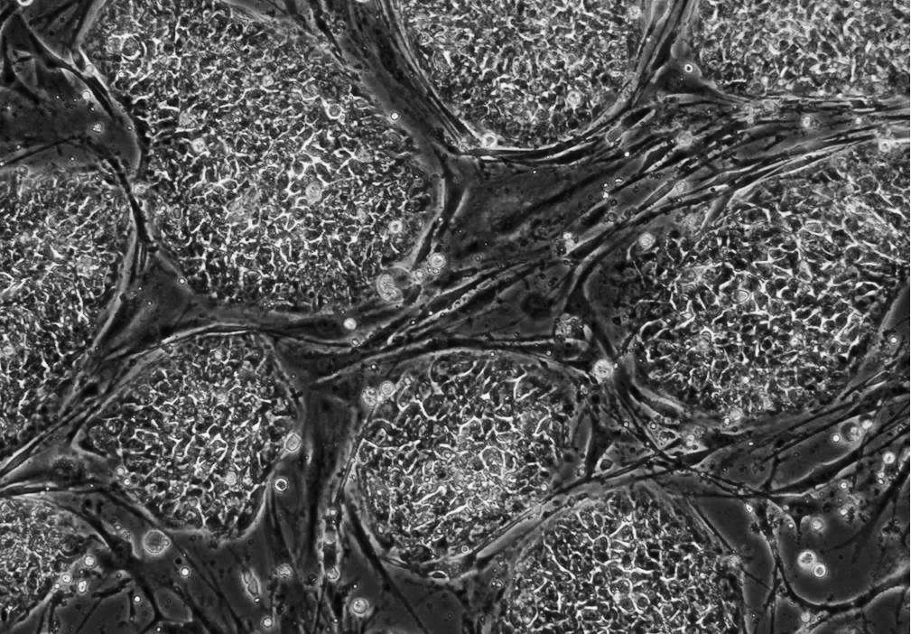 Cellules souches et dents de lait